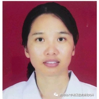 张丽娟