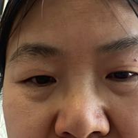 刘永红